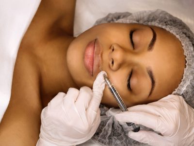 Aesthetic corrective treatments. Filler injections